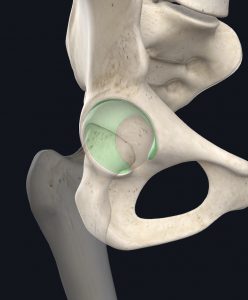 Anatomical picture of a hip's labrum