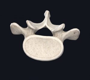 Top view of a lumbar vertebrae