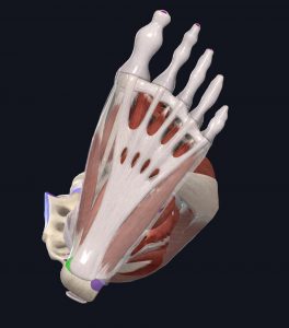 Medial calcaneus highlighted to show a painful point in the plantar fascia