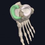 Medial meniscus of knee