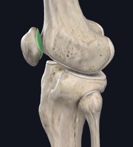 A side view of the knee and its patella