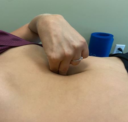 Diastasis Recti and Low Back Pain: Are They Related?