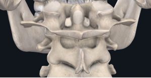 Anatomical image of C1 and C2