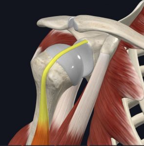 Anatomical image of the biceps attachment on the glenoid labrum